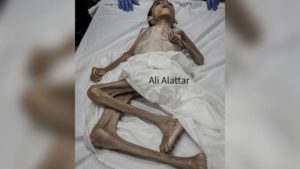 استشهاد طفل فلسطيني من المجاعة في غزة الإعلام الحكومي بغزة يؤكد انخفاض عدد شاحنات المساعدات لغزة