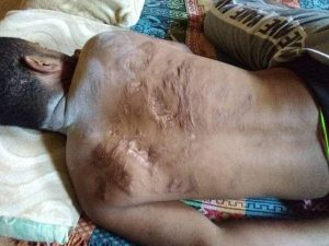 تعرض شاب لتعذيب وحشي داخل أحد سجون الانتقالي في عدن (صورة)