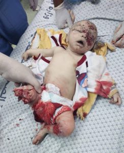 الطفولة في غزة بنك للاستهداف الصهيوني